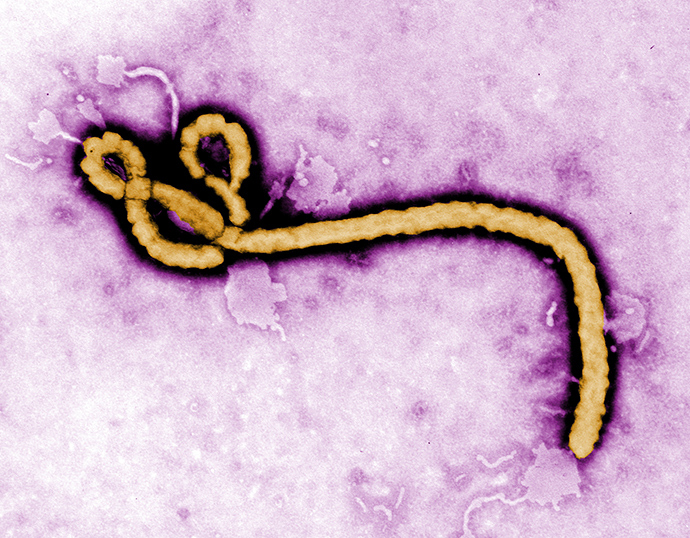 Some of the ultrastructural morphology displayed by an Ebola virus virion is revealed in this undated handout colorized transmission electron micrograph (TEM) obtained by Reuters August 1, 2014 (Reuters / Frederick Murphy)