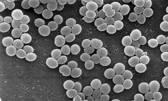 SEM micrograph of S. aureus colonies; note the grape-like clustering common to Staphylococcus species (Image from wikipedia.org)