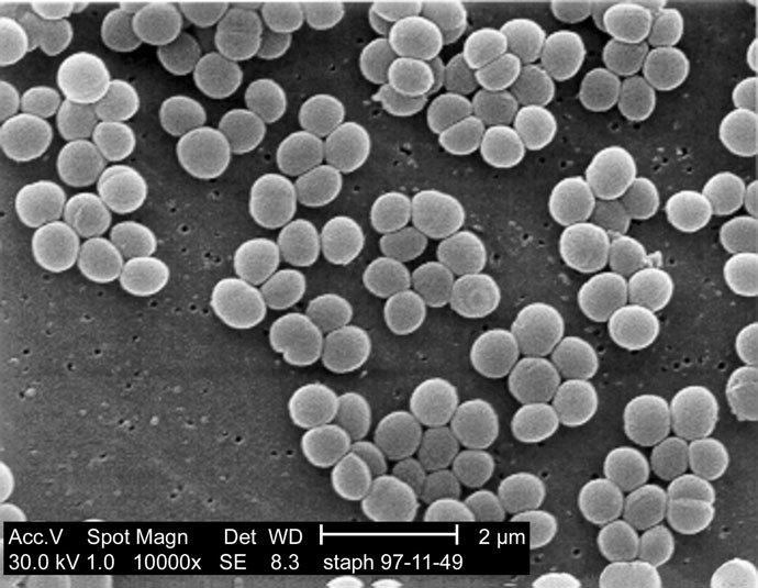Staphylococcus aureus bacteria (Image from wikipedia.org)