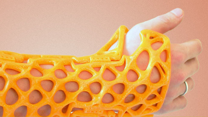 Russian startup 3D prints custom splints and plasters