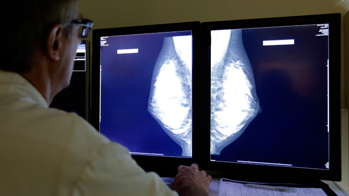 Osteoporosis Drug Protects Bones From Breast Cancer Metastasis – Study ...