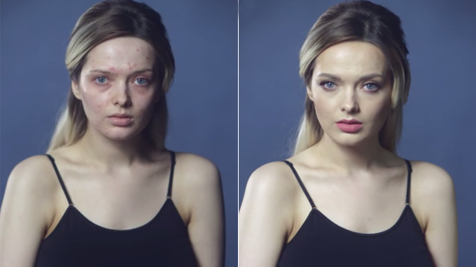 #YouLookDisgusting: Beauty blogger’s video exposes double standards of social media
