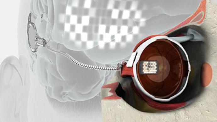 It’s a miracle! World’s first bionic eye gifts blind woman eyesight