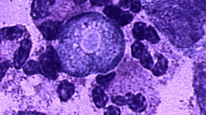 Deadly ‘brain-eating’ microbe outbreak in Pakistan