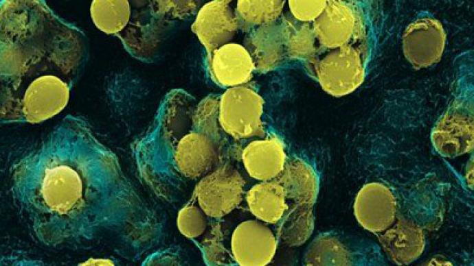 Killer strain: TDR tuberculosis strikes India