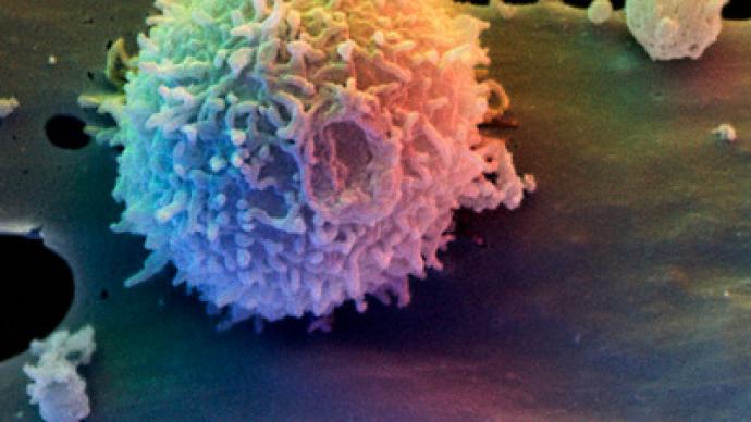 Immune system's door unlocked: Science finds out why specific cells let HIV in
