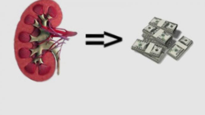 Survival of the fittest – turning kidneys into cash
