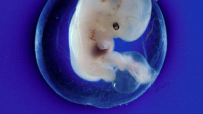 MP urges granting embryo citizen’s rights 