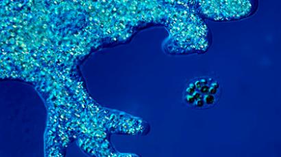 ​Simple amoeba can help fight Alzheimer's – research