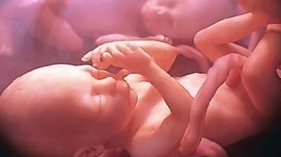 Texas House passes abortion restrictions despite public outrage
