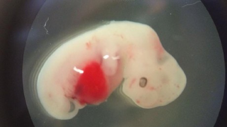 Des cellules humaines ont été injectées dans cet embryon de cochon