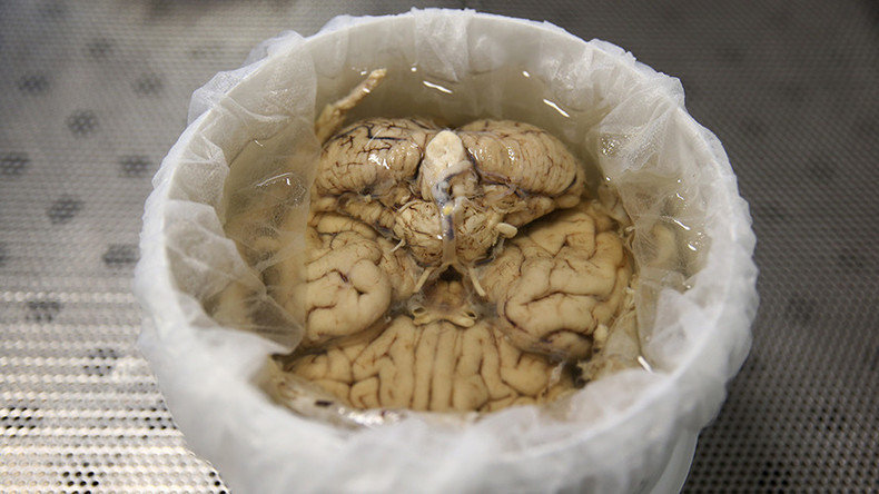 Russie : un jeune poète cannibale dévore le cerveau d'une femme lors d'un rendez-vous galant