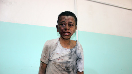 Un enfant yéménite attend d'être soigné dans un hôpital après avoir été blessé dans une attaque aérienne saoudienne dans la province de Saada, le 9 août 2018.
