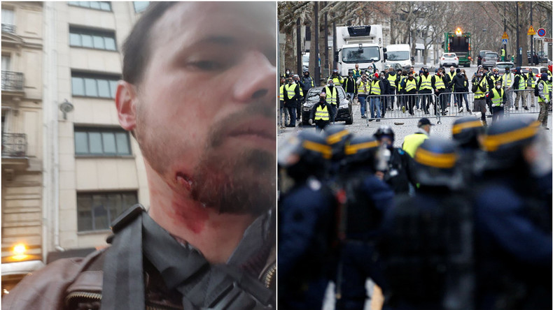 Un reporter de RT France blessé en pleine manifestation des Gilets jaunes