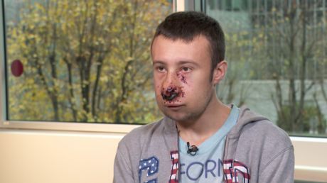 Julien, journaliste indépendant blessé au visage place d'Italie, témoigne pour RT France.