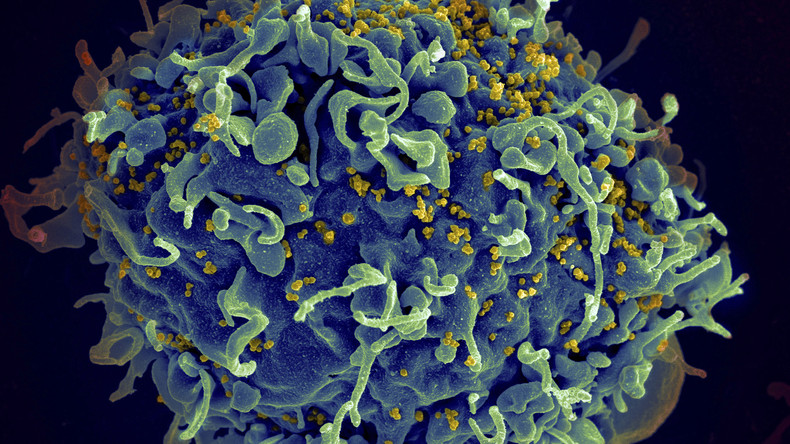 Cette image réalisée grâce à un microscope électronique montre un lymphocyte T attaqué par le VIH