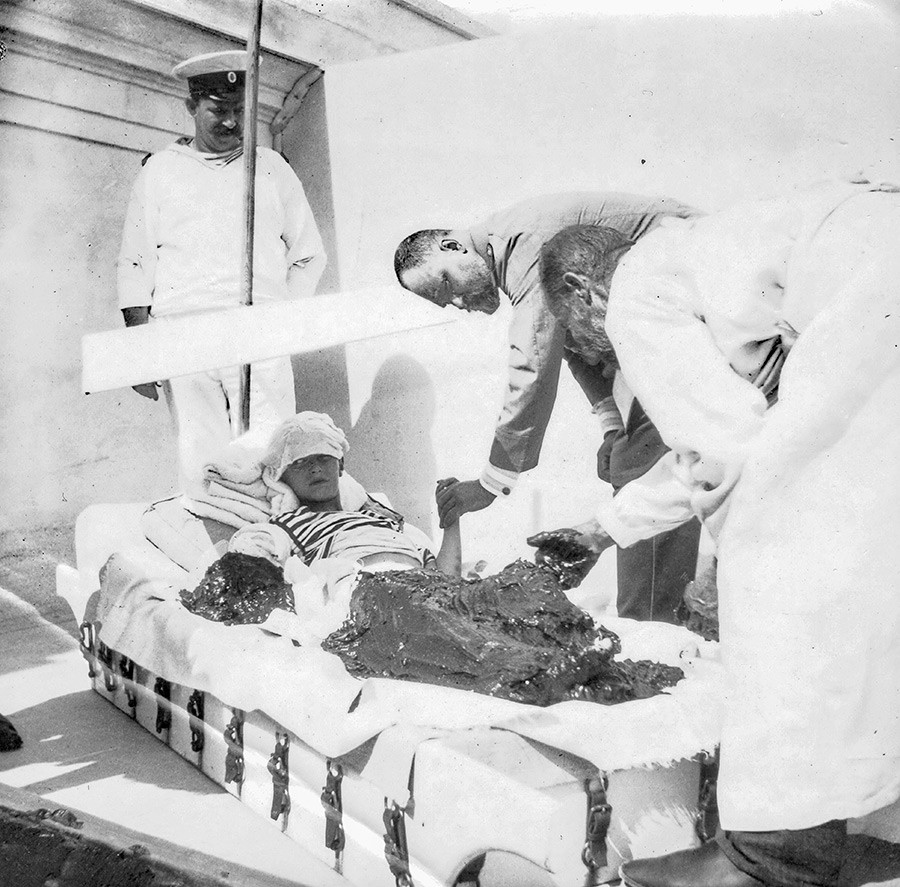 アレクセイ皇太子がリヴァディア、クリミアで泥浴で血友病の治療を行っている。後ろに立っているのは世話人のアンドレイ・デレヴェンコ、医師のボトキンが皇太子の左手を握っている。
