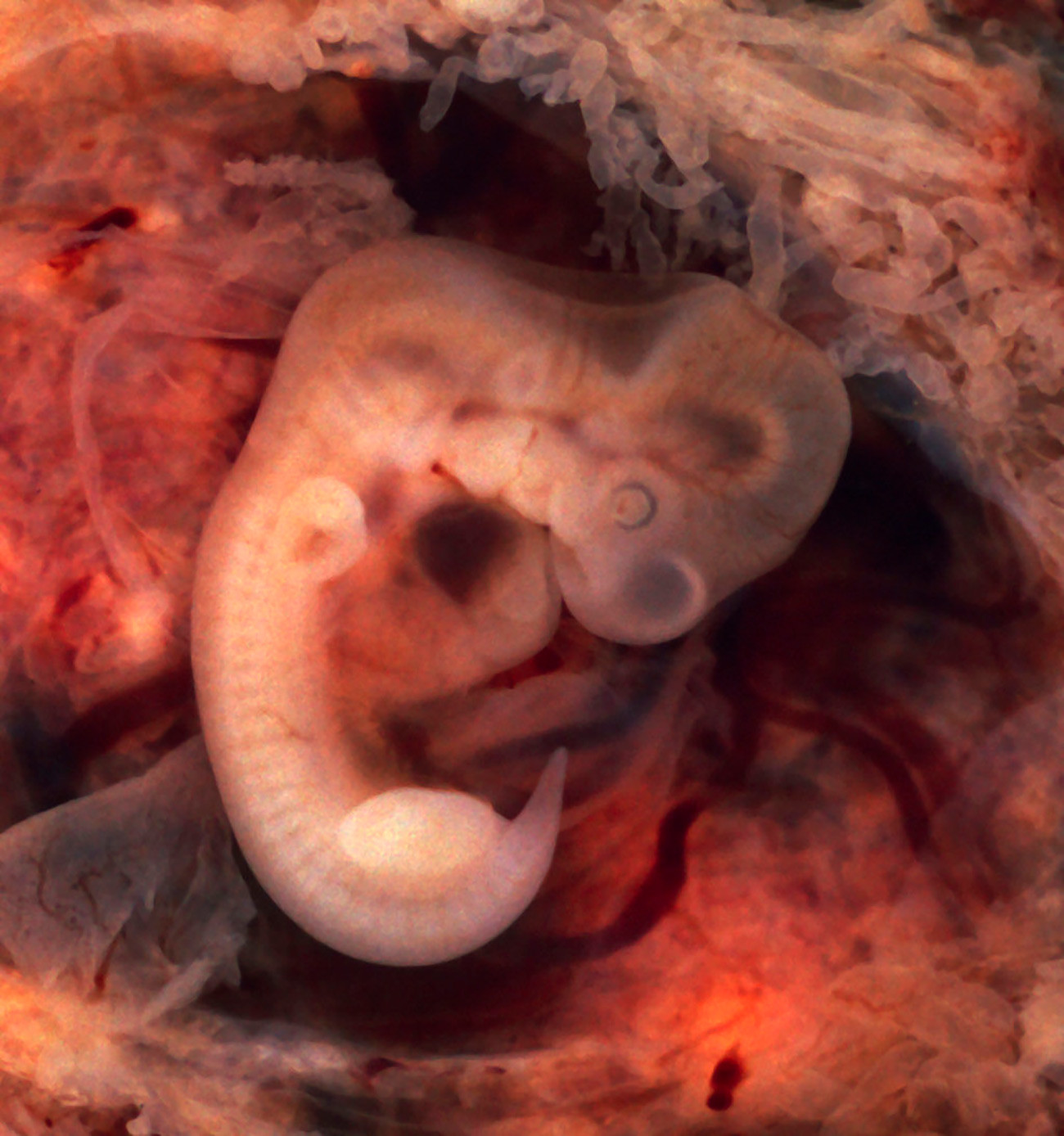 Так выглядит месячный эмбрион человека