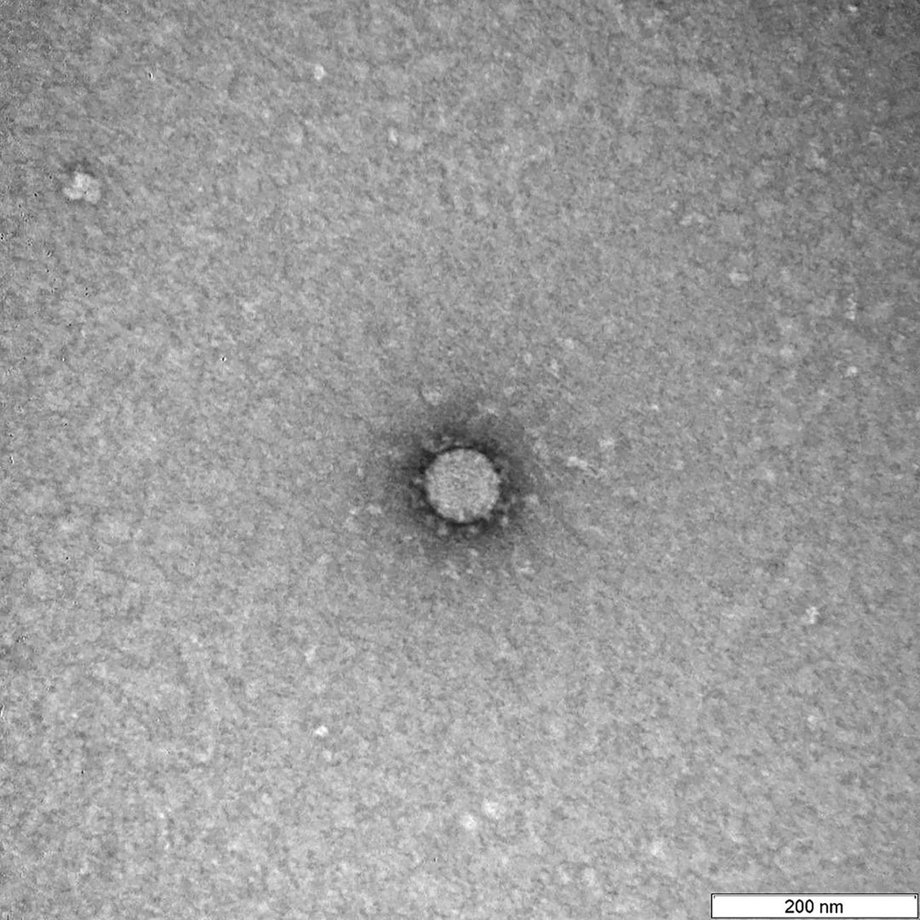 Снимки вируса COVID-19 через микроскоп в государственном научном центре вирусологии и биотехнологии 