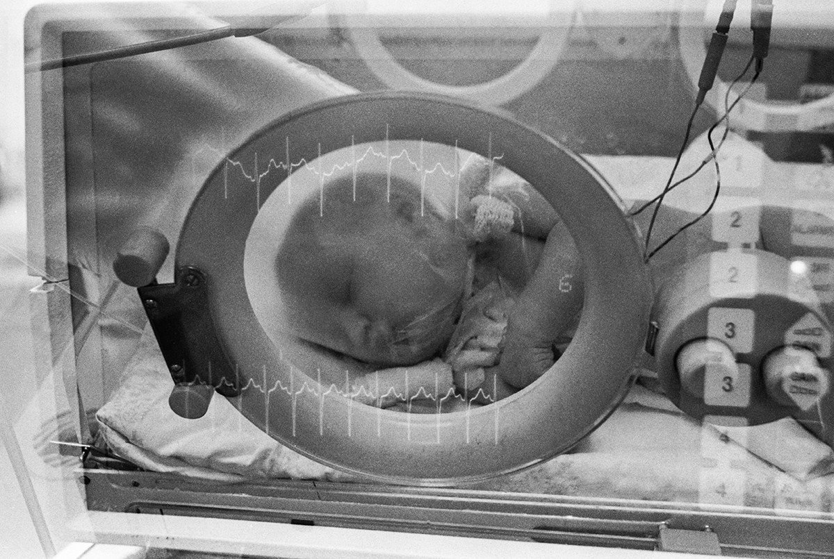 1° de abril de 1989. Um recém-nascido na incubadora.