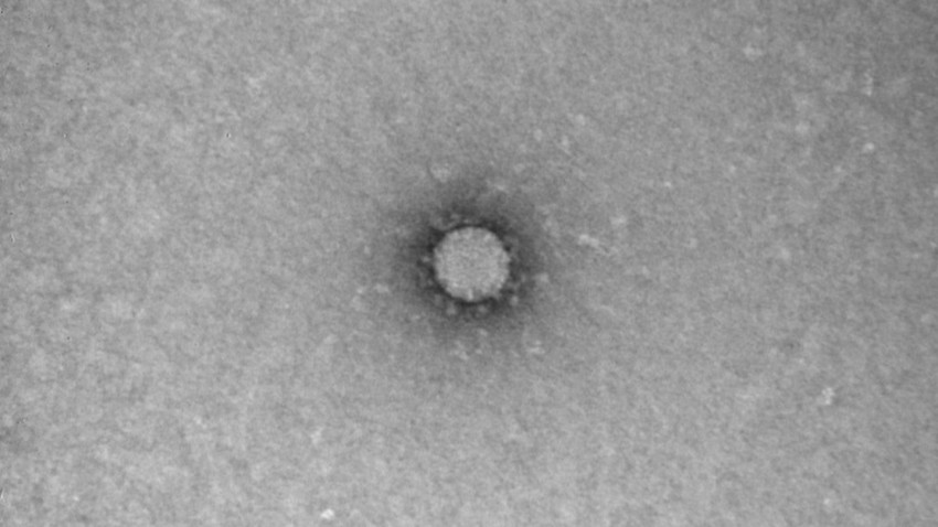Mikroskopska slika novega koronavirusa