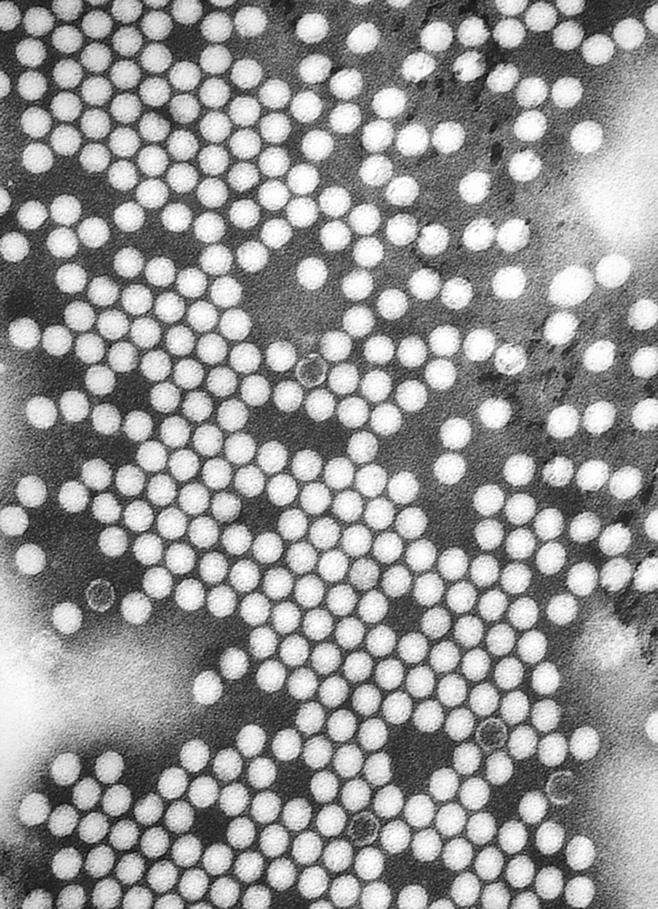 Micrographie électronique du virus de la poliomyélite