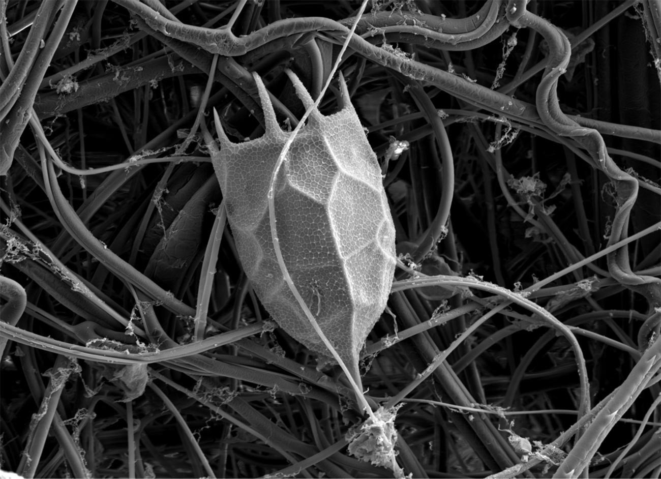 Locula of the rotifer Keratella cochlearis, scanning electron microscope image.