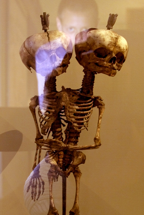 Le musée est surtout connu pour sa collection de "monstres" - des anomalies et bizarreries anatomiques, dont beaucoup furent achetées par Pierre le Grand en personne au cours de ses voyages en Europe.