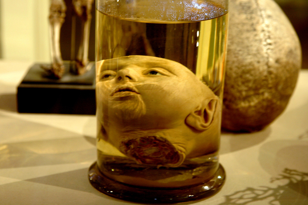 Някои от най-впечатляващите от милионите експонати се намират в колекцията на холандския анатом Фредерик Рюиш, който прекарва 50 години в колекциониране на "мокри" (запазени в етанол) екземпляри на новородени, включително и много човешки глави и отделни части от тялото. 