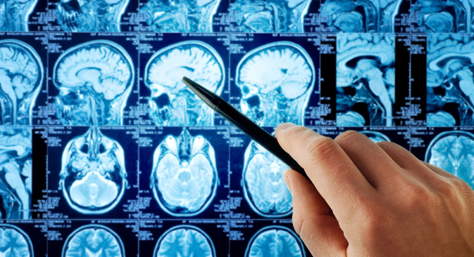 Злоћудни тумор на мозгу се не може увек удаљити у потпуности, јер је могуће да захвата функционално значајне делове. Извор: Shutterstock.