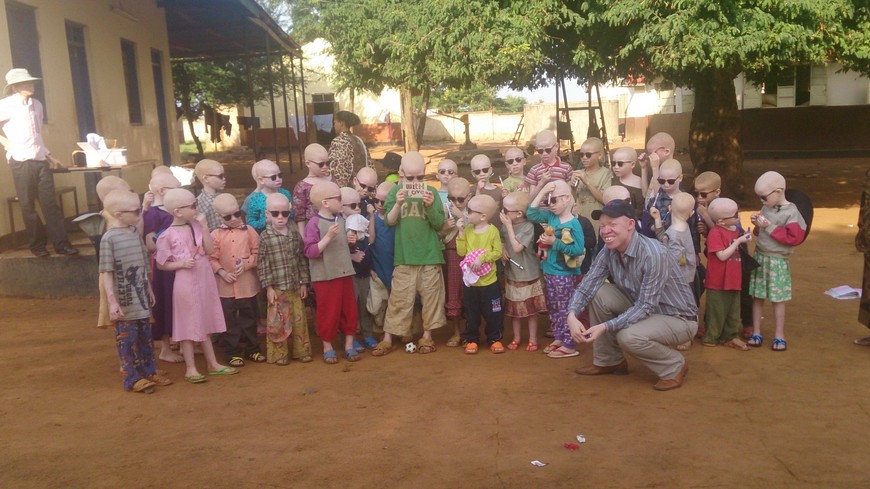 Africa albinos attacked in Tanzania